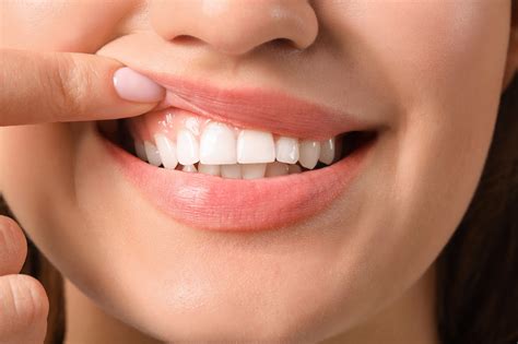 Regrow Gum Tissue: Restoring Your Smile Naturally