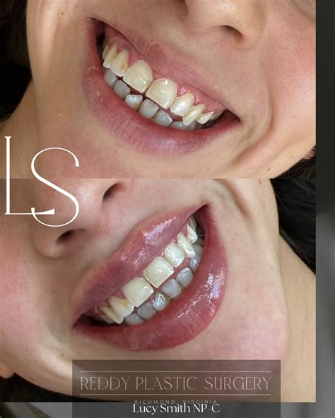 Reddy Plastic Surgery (@reddyplasticsurgery) • Instagram photos and videos