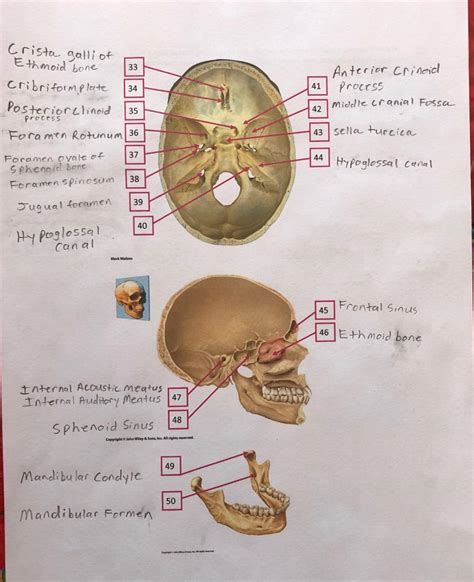 Crista Galli Anatomy