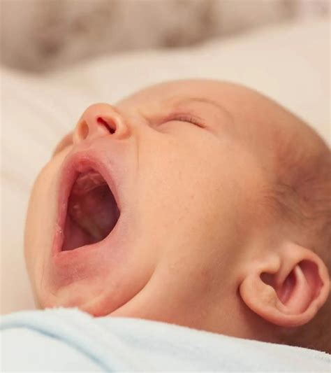 Epstein Pearls In Newborns: 4 Essential Facts