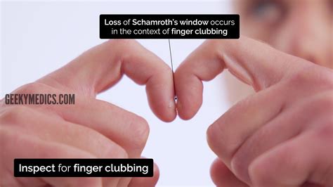 Respiratory Examination - OSCE Guide | Geeky Medics