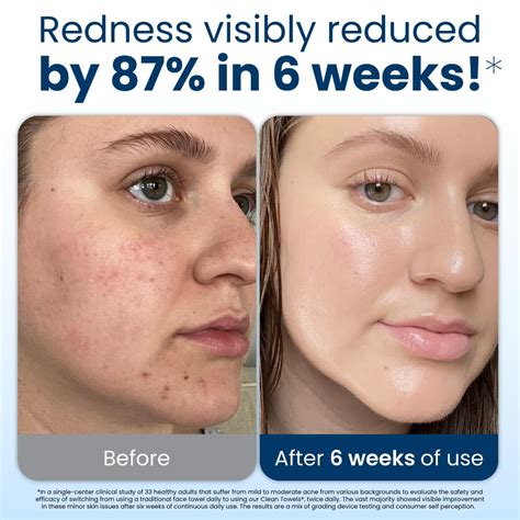 60% OFF Clean Towels XL - Clean Skin Club