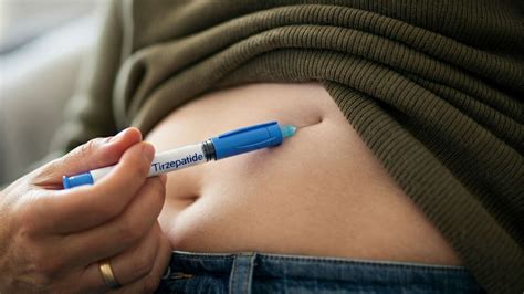 Tirzepatide for Treating Obesity and Preventing Diabetes
