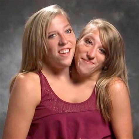 Conjoined twins Abby and Brittany Hensel reveal surprising details ...