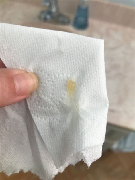 Mucus Plug Discharge Pieces