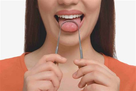 Treatment Swollen Taste Buds Transient Lingual Papillitis Wikipedia