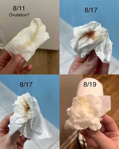 Bleeding When Ovulation