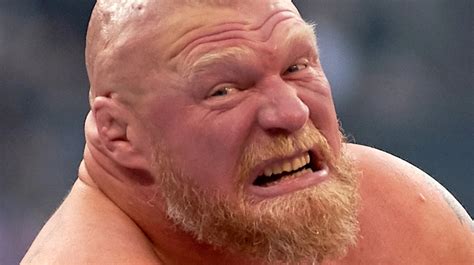WWE Brock Lesnar Teeth Fixed Now? Before and Afters | LEMA
