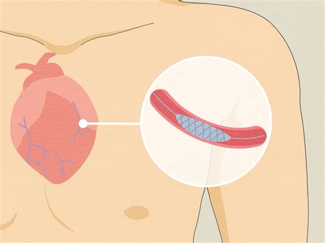 Anatomy Of The Left Arm