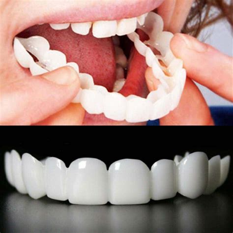 Amazon.com: Adjustable Teeth Veneers Dentures for Men and Women Fake Teeth ，snap on veneers ...