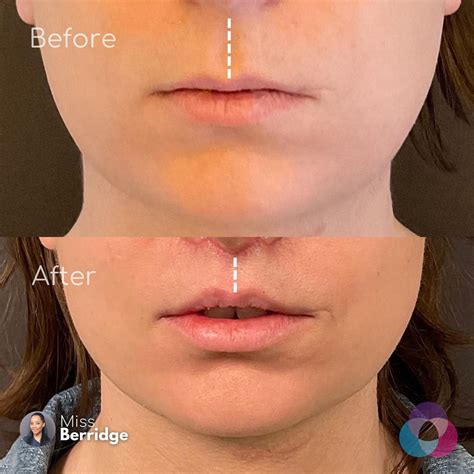 The Gallery – Face Surgery Doctor – Natasha Berridge – Maxillofacial & Oral