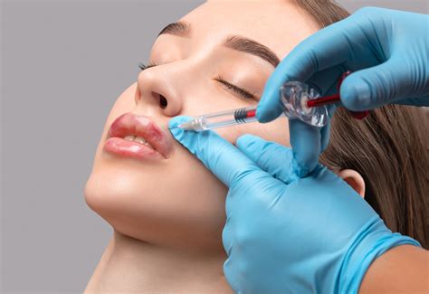 Botched Lip Filler: What You Need to Know
