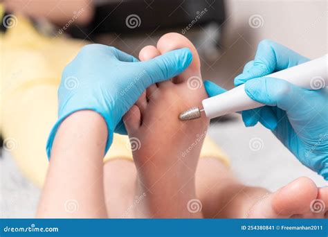 Are Chiropodists Medical Doctors