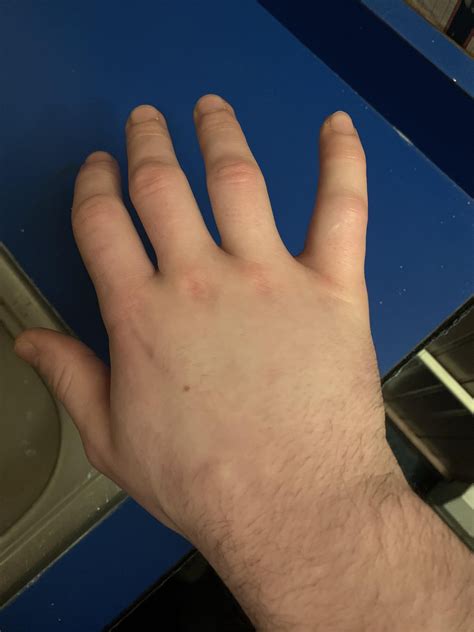 For those wondering how much a centipede sting hurts: here you go : r/centipedes