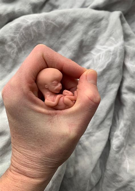 Fetus At 10 Weeks | ubicaciondepersonas.cdmx.gob.mx