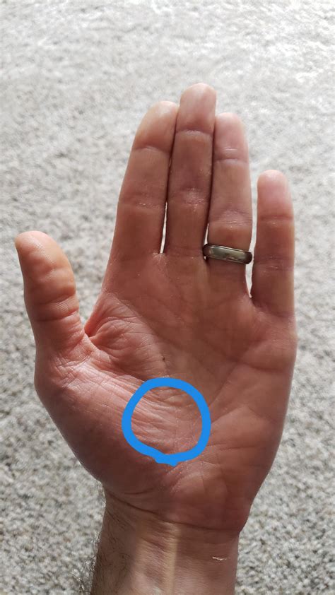 Sharp Pain In Palm Under Thumb at Nicole Webber blog