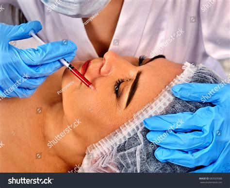 23 Lip Fillers Older Patient Images, Stock Photos & Vectors | Shutterstock