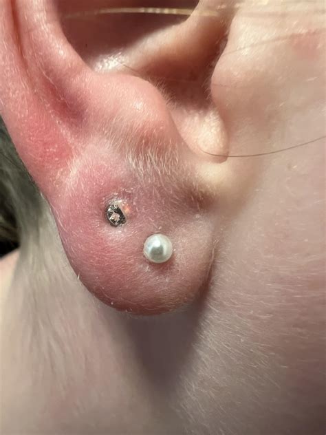 Nose Piercing Rejection Nose Piercing Rejection | Illustrated Guide To