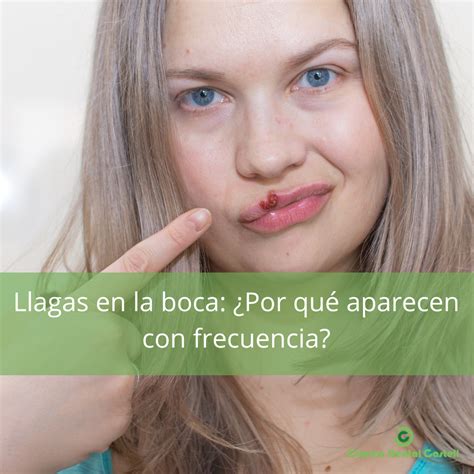 Como Curar Llagas En La Espalda at Helen Williamson blog