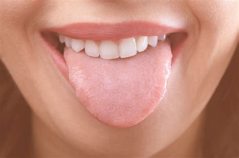 Scalloped Tongue: Causes and Treatment