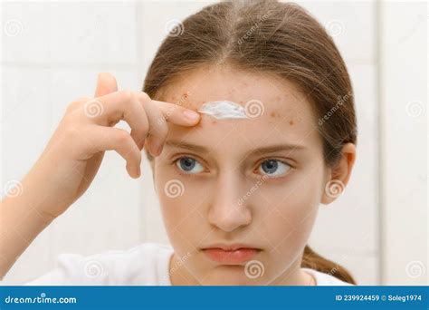 La Chica Pone Crema En La Cara De Una Adolescente Con Acné De Granos En La Piel Que Se Mira En ...