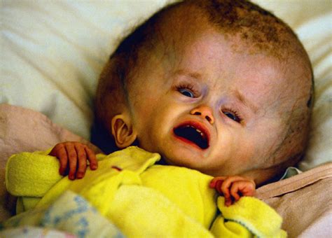 Jellyfish Babies Pacific Islanders