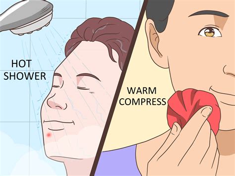 Teresa Caruso: How To Make A Pimple Go Away