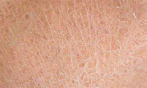 How to maintain a smooth bikini line during dry winter months - Bushbalm