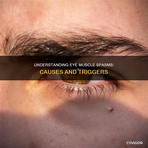 Understanding Eye Muscle Spasms: Causes And Triggers | CyVigor