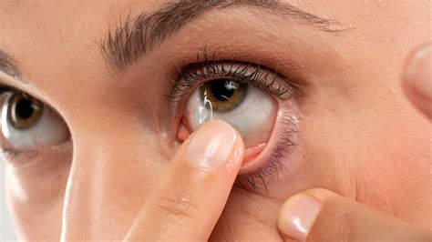 Extended Wear Contact Lenses: #1 Ultimate Guide