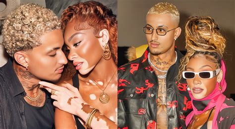 Who Is Kyle Kuzma’s Supermodel Fiancée, Winnie Harlow?