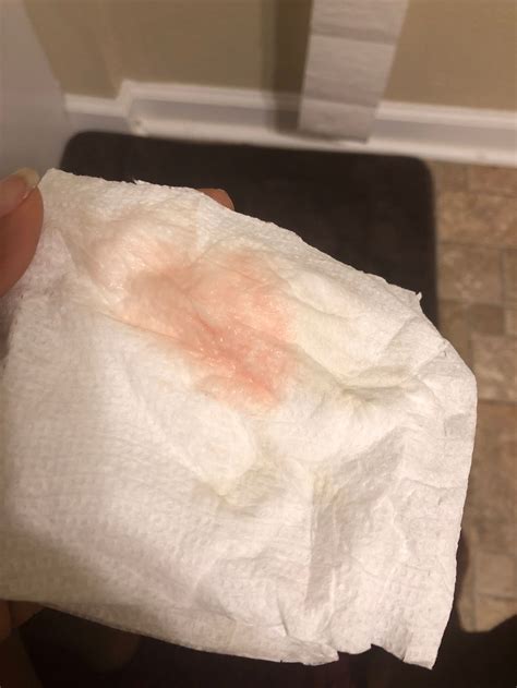 Light Pink Bleeding After Period
