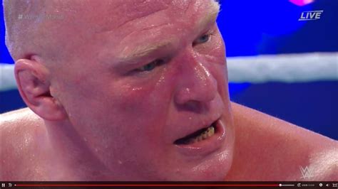 WTH? Something Seriously Wrong With Brock Lesnar's Teeth - Fitness Volt