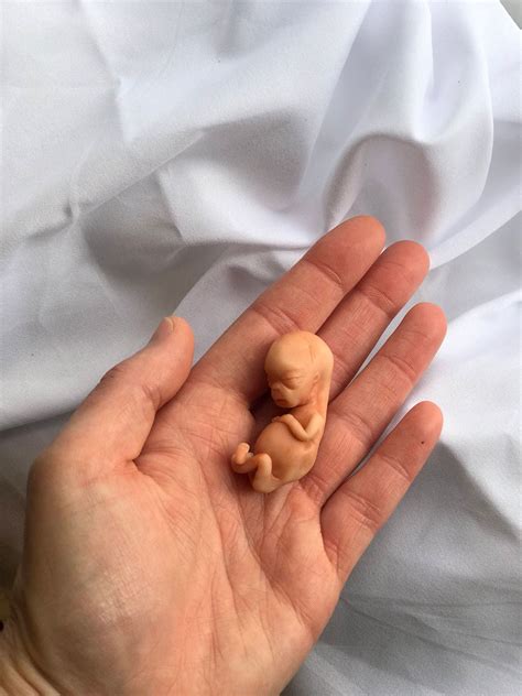 What Size Is A 10 Week Old Fetus at Carol Godsey blog