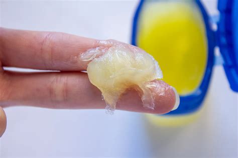 How Long Should You Use Vaseline After Mohs Surgery? | Dermatology and ...