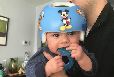 Flathead Babies Helmets Flat Heads