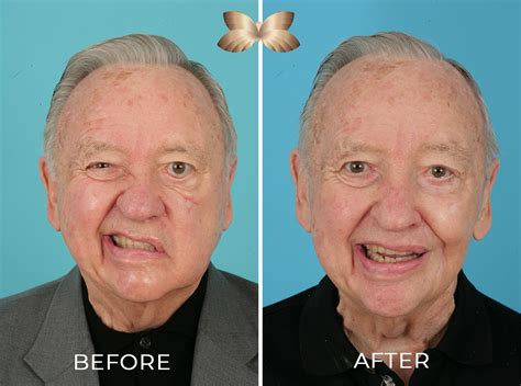 Common Causes and Treatments for Facial Nerve Damage