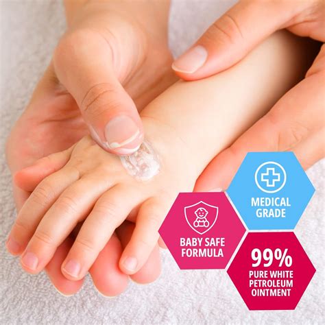 Burn Treatment Petroleum Jelly at Norma Hannon blog