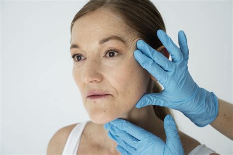 What to Expect Before, During, After Laser Age Spot Treatment