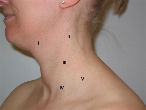 Lymph Nodes In Neck Cancer