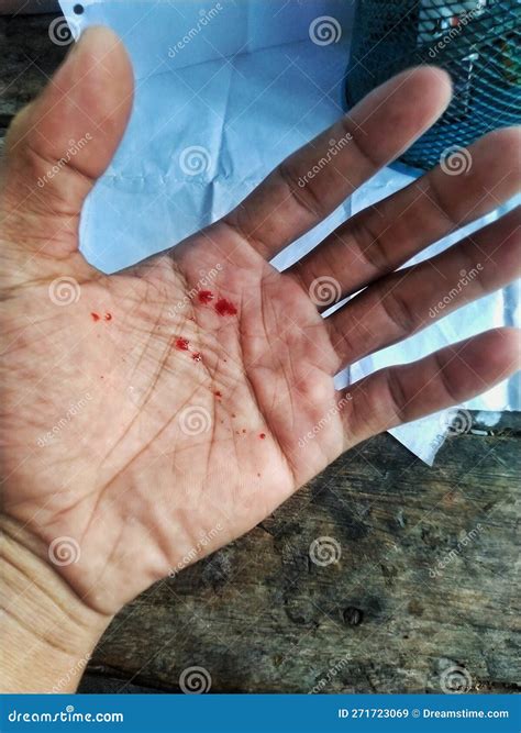 Palms with red blood spots stock image. Image of hand - 271723069