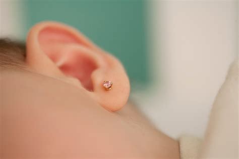 Blackhead In Ear