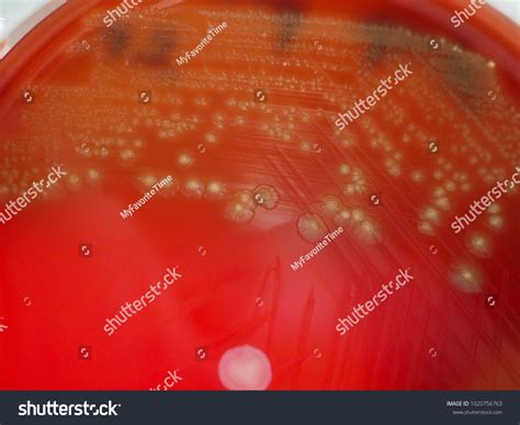 Blood Agar Alpha Hemolysis