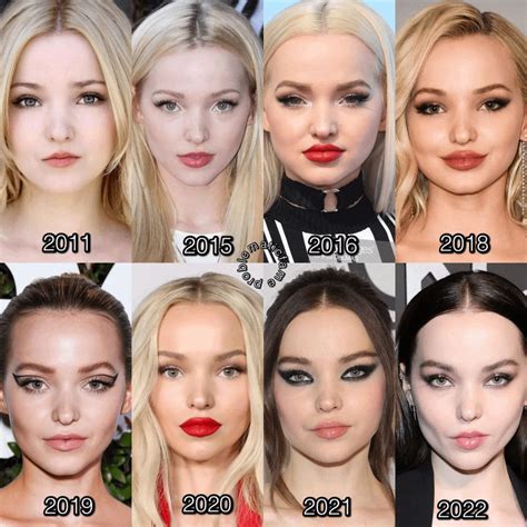 Califica a Dove Cameron antes y después de la cirugía plástica : r/VindictaRateCelebs