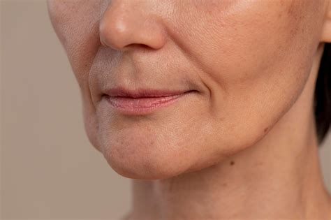Sagging Jowls: Causes, Treatment, and Prevention - Bodycraft - Salon, Skin, Clinic & Spa