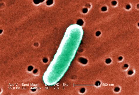 45+ Escherichia coli imágenes gratis