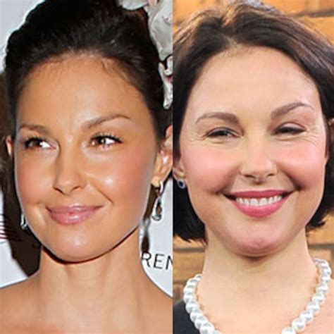 What Happened To Ashley Judd'S Face? - Rising Net Worth