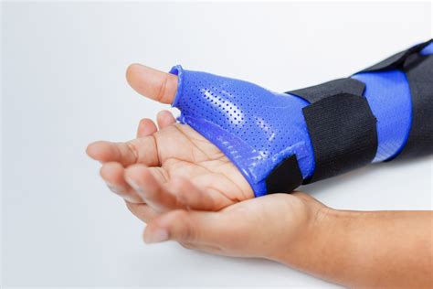 Hand therapy for De Quervain's - Hand Therapy Centre