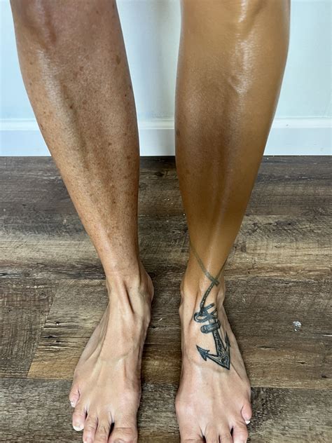 How to Cover Varicose Vein's | How to cover varicose veins, Tattoos to ...