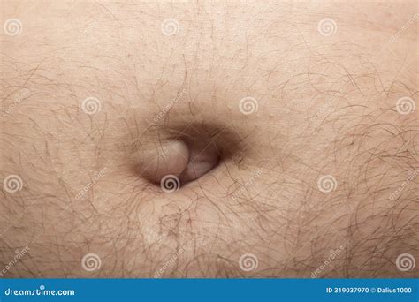 Lump In Belly Button - Hernia, An Inflammatory Condition - Possible Cancer Stock Photo ...
